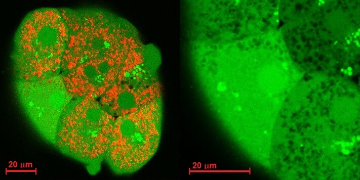 Leberzellen unter dem Laser-Scanning-Mikroskop