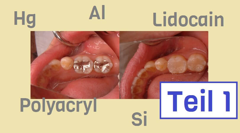 Die Geschichte von Zahn 16 : Chemie beim Zahnarzt