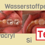 Chemie beim Zahnarzt