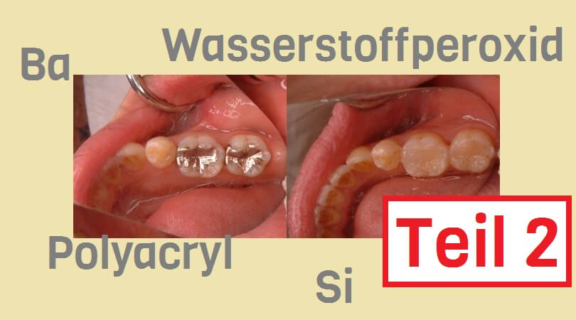 Chemie beim Zahnarzt