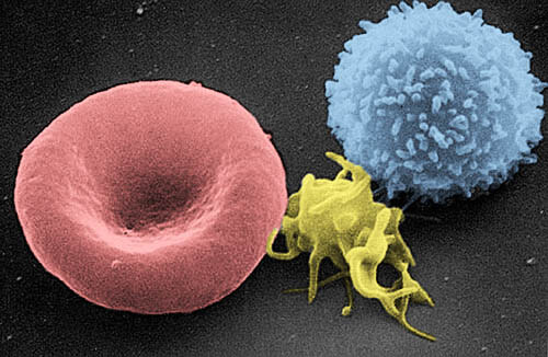 Blut-Zellen unter dem Elektronenmikroskop