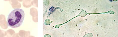 links: Neutrophiler Granulozyt, rechts: Makrophage