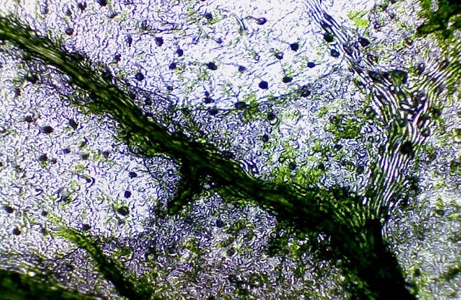 Blätter unter dem Mikroskop, mit sichtbaren Spaltöffnungen