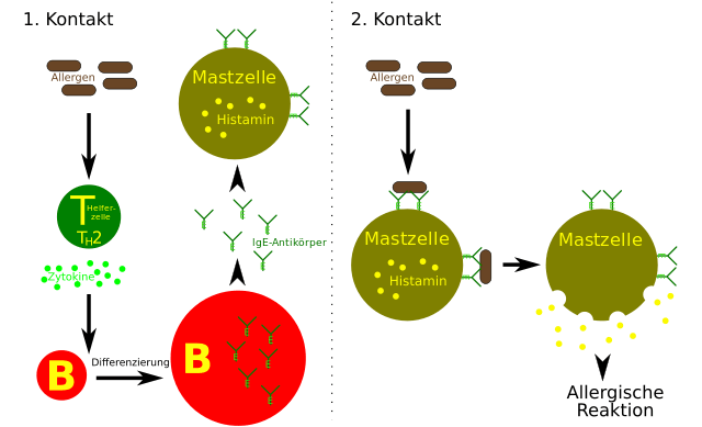 Allergie : Mechanismus allergische Reaktion vom Typ I