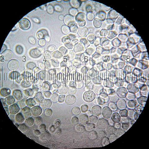 Backhefe unter dem Mikroskop: Die Einzelzellen sind jetzt gut erkennbar.