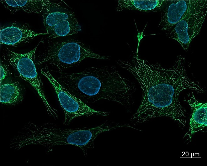 menschliche Zellen unter dem Fluoreszenzmikroskop: Der Zellkern ist blau, das Zellskelett grün gefärbt