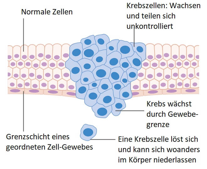 Schema: Krebszellen durchdringen eine Gewebegrenze