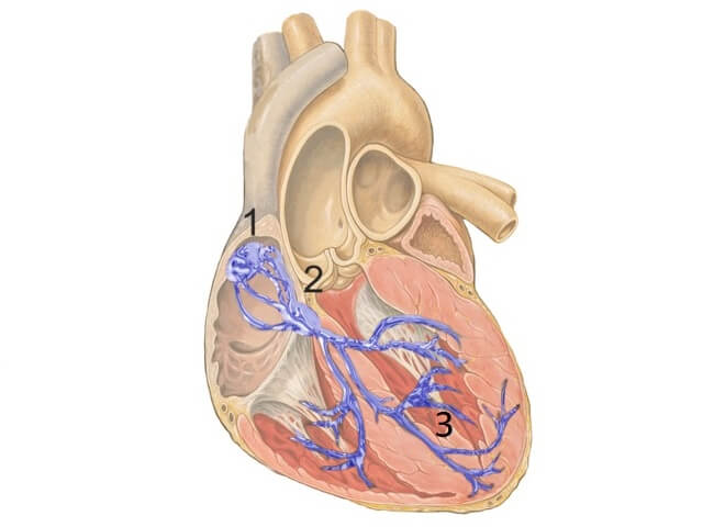 Längsschnitt durchs menschliche Herz mit eingezeichneten Reizleitungen
